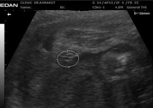 ลุ้นกว่าหวย...ก็เพศลูกนี่เเหละค่ะ