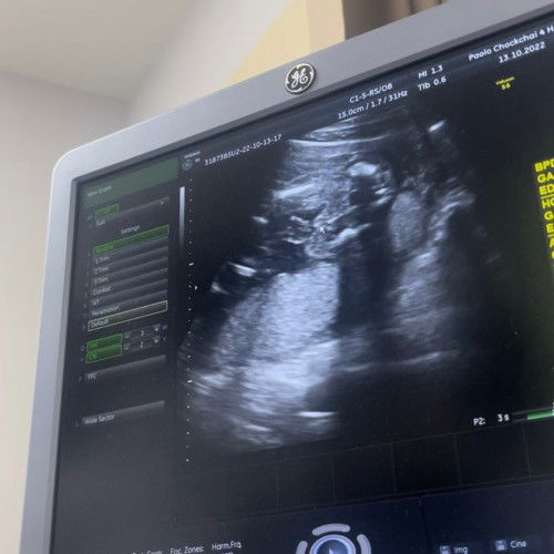 ช่วยดูเพศน้องหน่อยค่าา