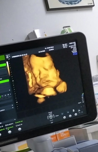 ทีม พฤศจิกายน