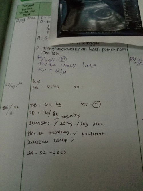 posisi bayi sungsang saat usia 20 week