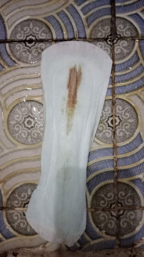 Keputihan Berwarna Coklat Seperti Flek