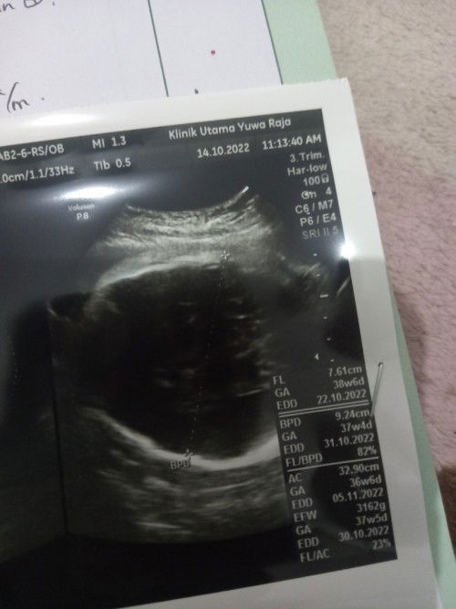 Pengalaman lahir sesuai HPL