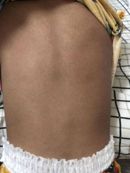 Tigdas Hangin po ba ito?????