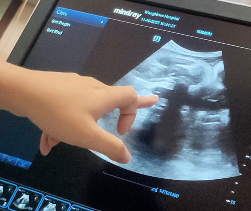 สอบถามรอบ2จ้า 🙏