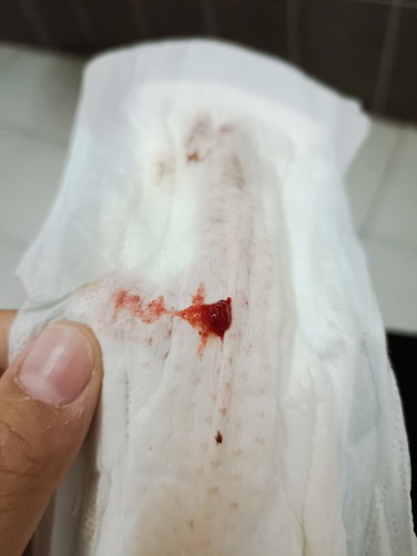 เลือดล้างหน้าเด็กหรือป่าว????