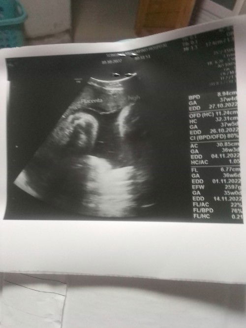 สอบถามหน่อยค่ะ ภาพอัลต้าซาวส์ใบนี้ บอกเพศไหมค่ะ แม่ไม่มีความรู้เรื่องนี้เลย😄
#ขอบคุณค่ะสำหรับคำตอบ