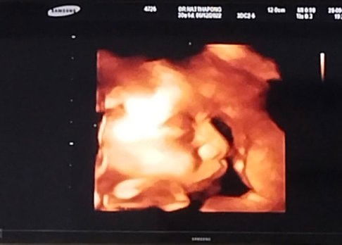 มาโชว์ลูกชายลูกสาวกันค่ะ