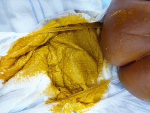 Tekstur BAB Bayi usia 3 bulan lebih