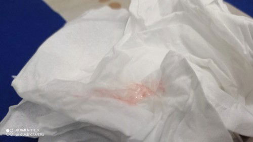 Hpl 27 usia kehamilan 38 m