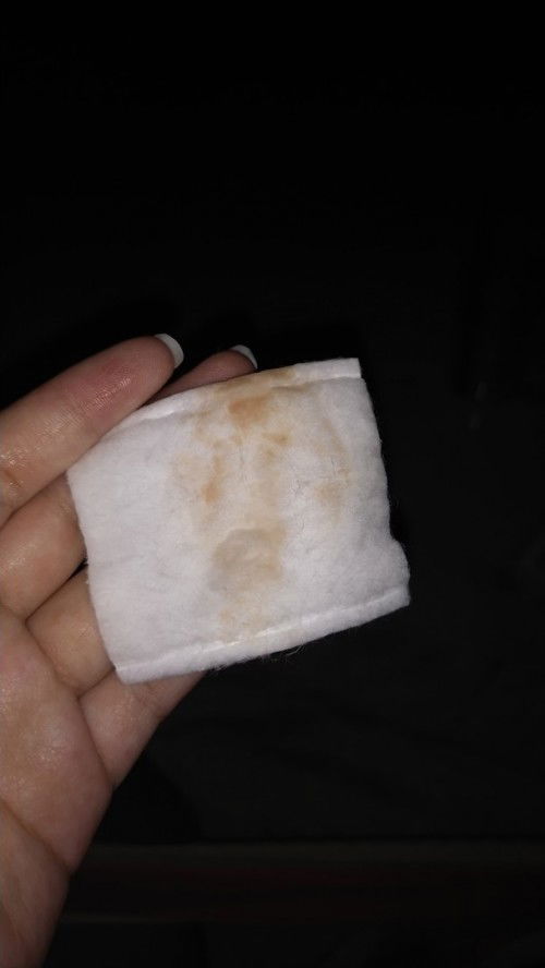 อายุครรภ์ 40+