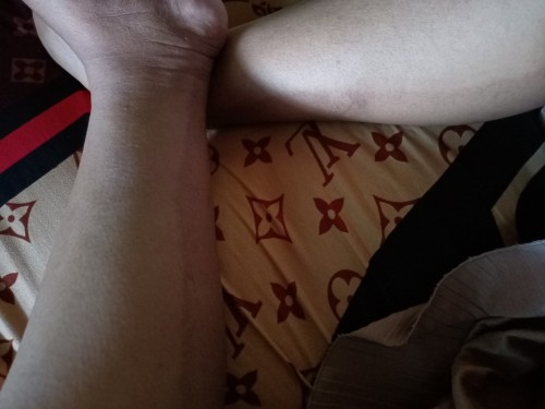 Kaki belang saat hamil