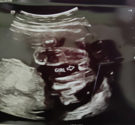 Gender scan