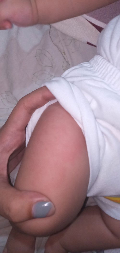 2days after maturukan ng pentavalent