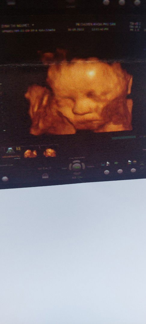 Cân nặng thai nhi