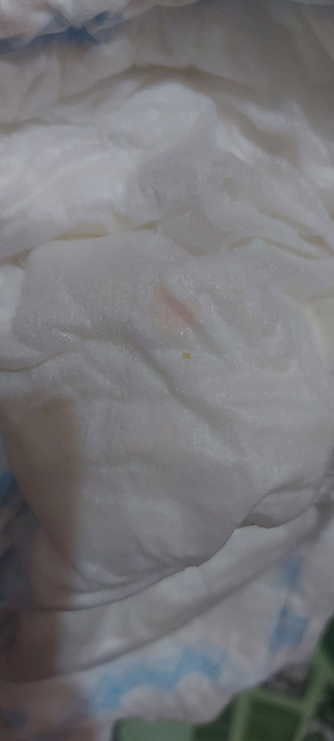 May kulay orange or pink sa diaper ni baby.