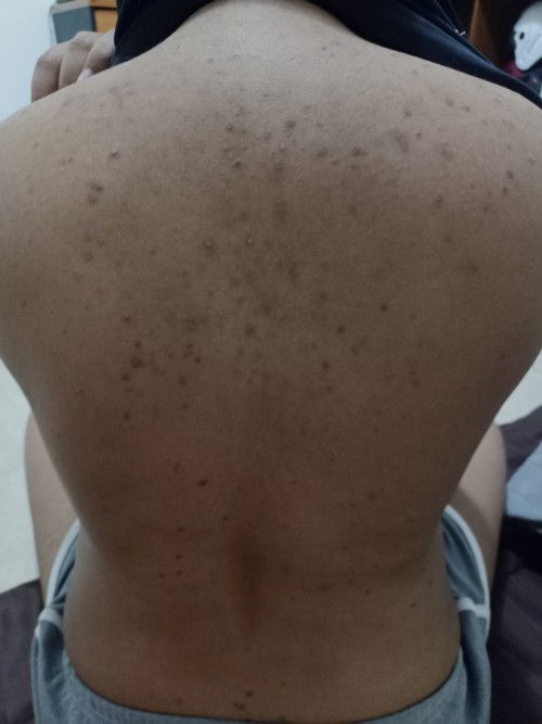 แม่ๆบ้านไหนเป็นเหมือนกันบ้าง