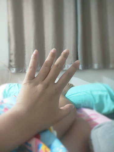 มือ เท้า บวมหนักมาก