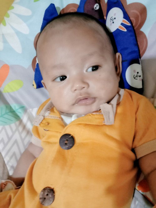 Cara Mengatasi Bintik Putih
