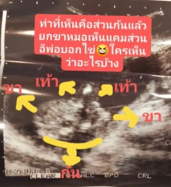 16สัปดาห์