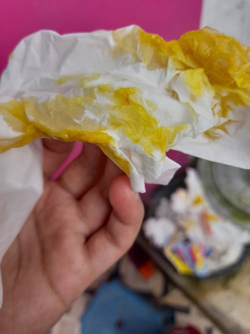 Bab bayi lendir campur darah