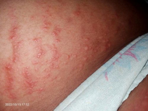 Gatel bintik bintik merah di bagian badan