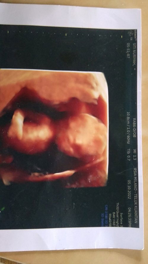 assalamualaikum bunda..saya mau tanya ini jenis laki ato perempuan ya? soalnya saya lupa tanya ke do