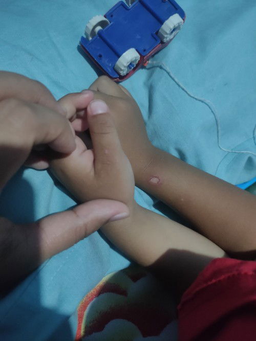 Bintik putih di tangan