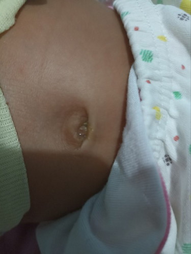 Pusar belum kering