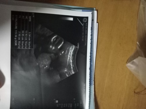 ตามภาพเลยจ้า