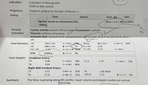Need to be induced at 37w