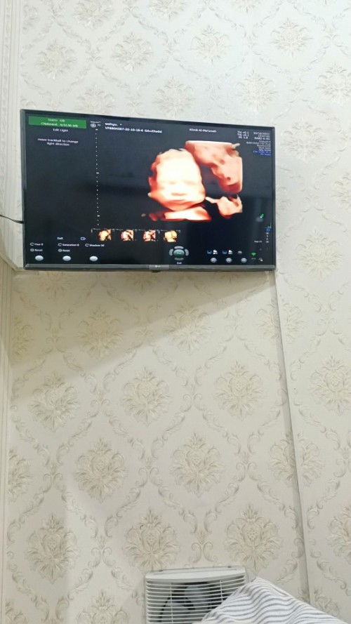 MashaAllah tabarakallah