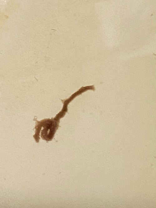 Spotting or Bleeding?