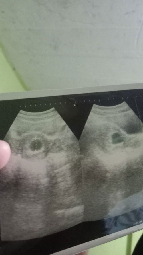 Janin tidak berkembang