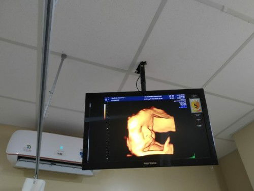 Mau tanya bun, apakah mulutnya normal? Maaf bun saya worry, jangan di bully ya. 🥺🥺🥺🥺🥺🥺🥺