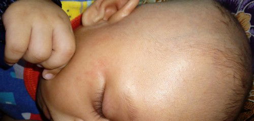 Wajah merah bayi