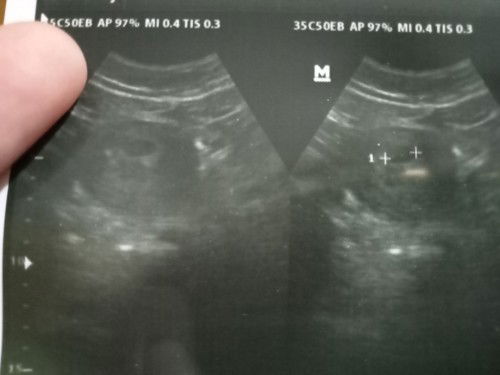 Bismmilahh kehamilan pertama selama 4th