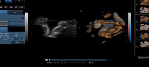 Perempuan atau laki laki