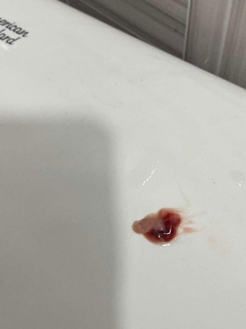 Keluar darah saat hamil 7bln