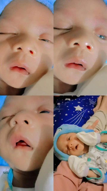 Kenaikan berat badan yg tidak signifikan di 1 bulan pertama