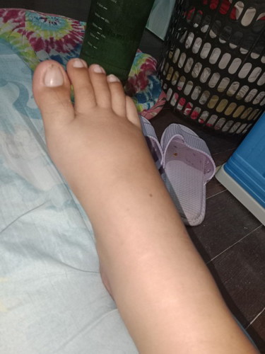 Gamot sa pamamanas