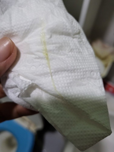 Yellowish discharge