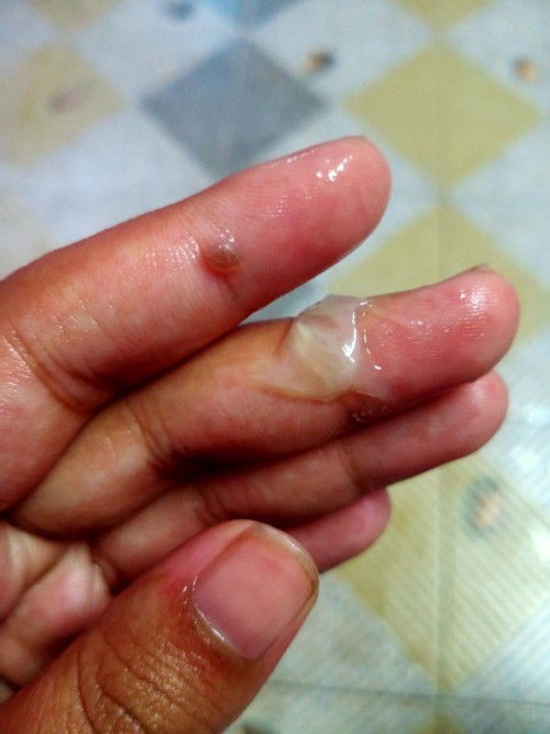 ท้อง38สัปดาห์มีมูก