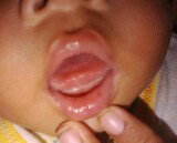 Bun ini knp ya?
