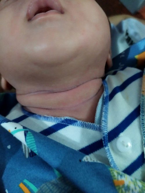 Buang keringat oada bayi 1 bulan