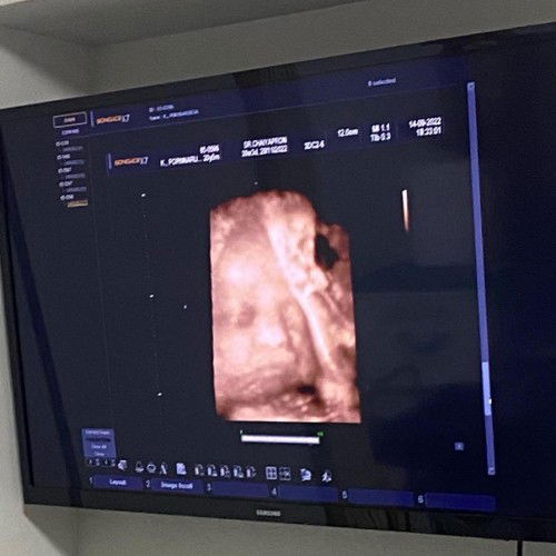 เด็กน้อยใกล้เจอกันแล้ว