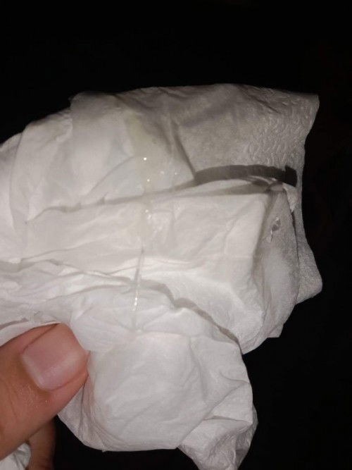 มีมูกใสออกมาค่ะ