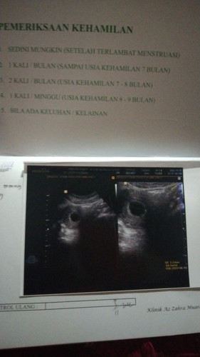 hamil 6w5d kta dr blm ada djj nya, sejauh ini tdk ada pndarahan keluahn sya mual sma tdk napsu mkn