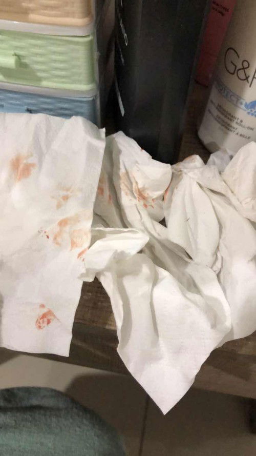 Spotting 3rd trimester