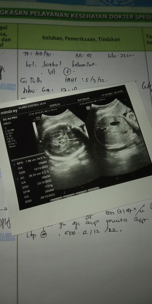 HPL 10 Desember 2022 ❤️