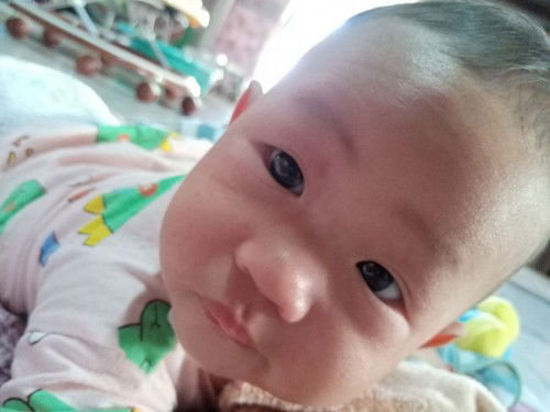 ผื่นที่หน้า